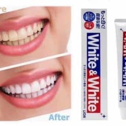 Kem Đánh Răng White And White Nhật 150g